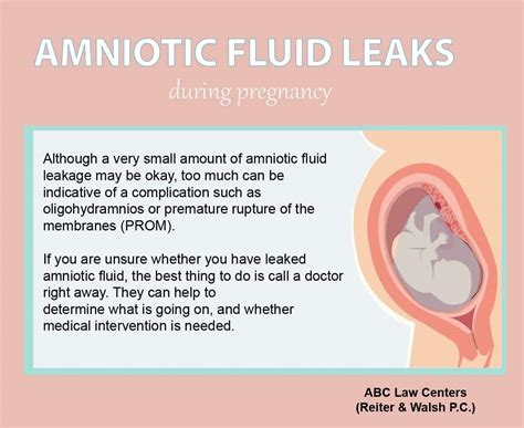 how do you know your leaking amniotic fluid|Signs Of Leaking Amniotic Fluid Vs. Discharge: The Difference